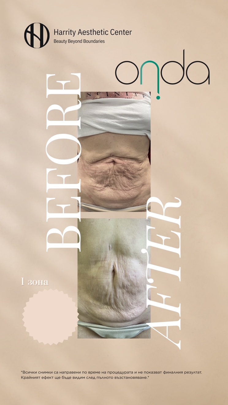 Harrity Stories - 21
